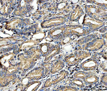 Anti-FATP4/SLC27A4 Antibody