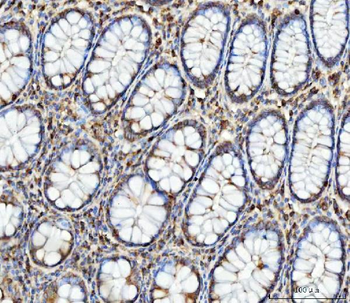 Anti-FATP4/SLC27A4 Antibody