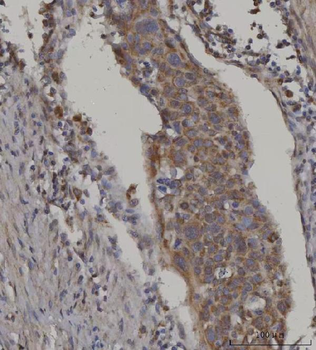 Anti-FATP3/SLC27A3 Antibody