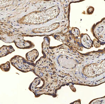 Anti-SLC25A24 Antibody