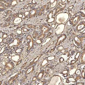 Anti-SLC25A24 Antibody