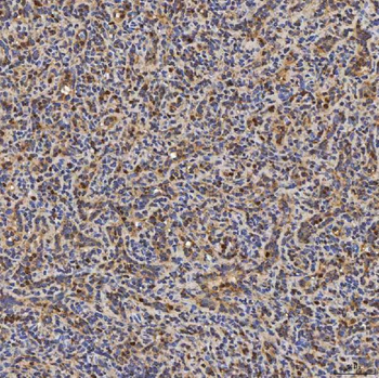 Anti-SLC25A24 Antibody