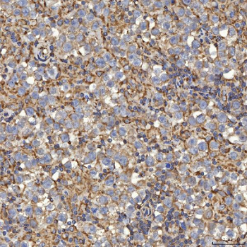 Anti-SLC25A24 Antibody