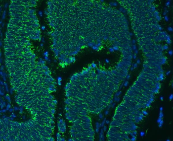 Anti-SLC25A24 Antibody