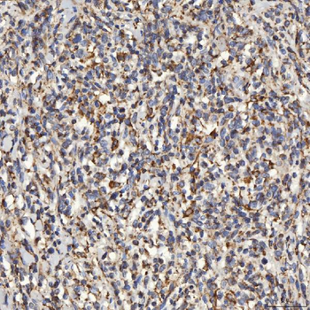 Anti-SLC25A24 Antibody