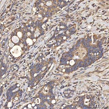 Anti-SLC25A24 Antibody