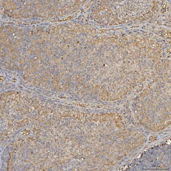Anti-SLC25A24 Antibody