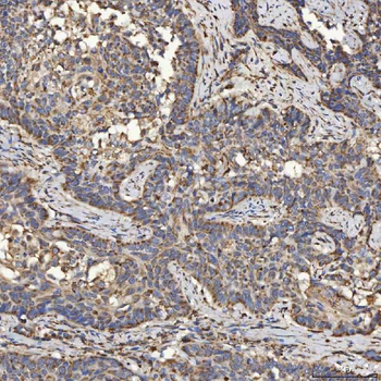 Anti-SLC25A24 Antibody