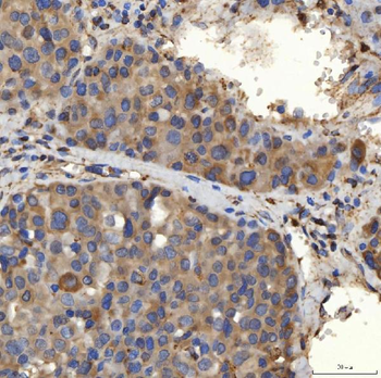 Anti-SLC25A24 Antibody