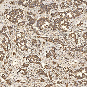 Anti-SLC25A24 Antibody