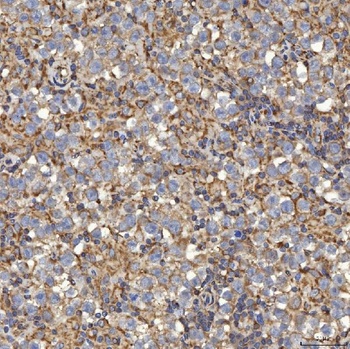 SLC25A24 Antibody