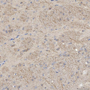 Anti-SLC25A23 Antibody