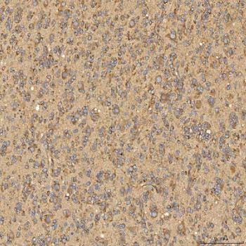 Anti-Citrin/SLC25A13 Antibody