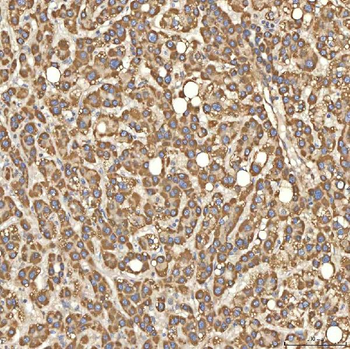 Anti-Citrin/SLC25A13 Antibody