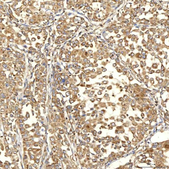 Anti-Citrin/SLC25A13 Antibody