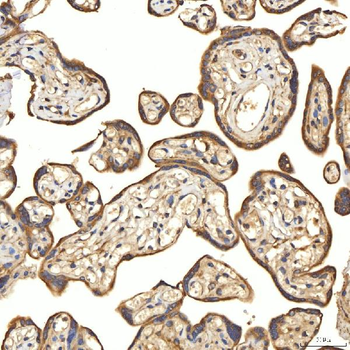 Anti-Citrin/SLC25A13 Antibody
