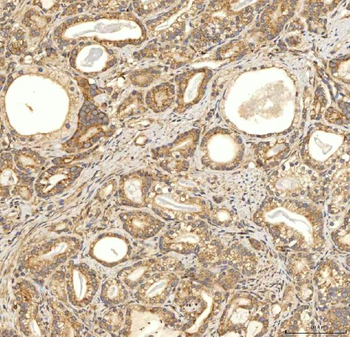 Anti-Citrin/SLC25A13 Antibody