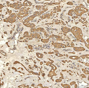 Anti-Citrin/SLC25A13 Antibody