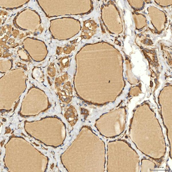Anti-Citrin/SLC25A13 Antibody