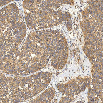 Anti-Citrin/SLC25A13 Antibody