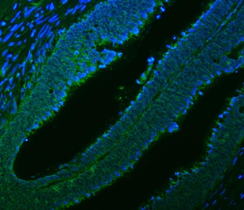 Anti-Citrin/SLC25A13 Antibody