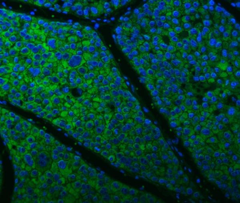 Anti-Citrin/SLC25A13 Antibody