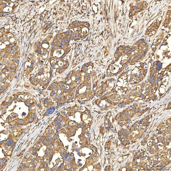 Anti-Citrin/SLC25A13 Antibody