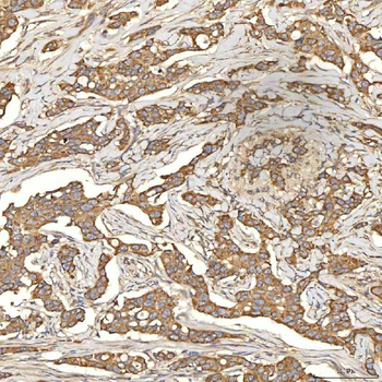 Anti-Citrin/SLC25A13 Antibody