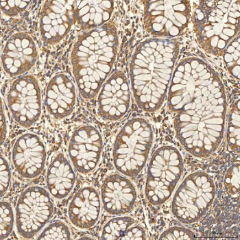 Anti-Citrin/SLC25A13 Antibody