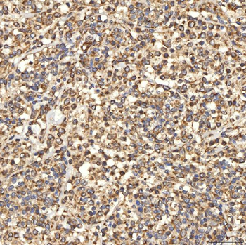 Anti-Citrin/SLC25A13 Antibody
