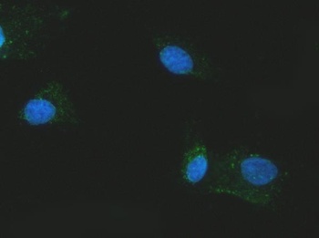 Citrin/SLC25A13 Antibody