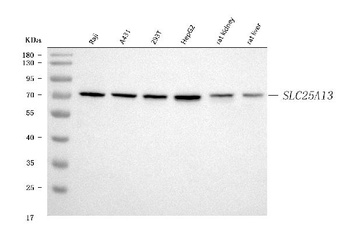 Citrin/SLC25A13 Antibody