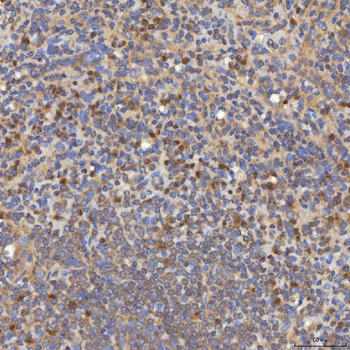 Anti-Mitochondrial dicarboxylate carrier/SLC25A10 Antibody
