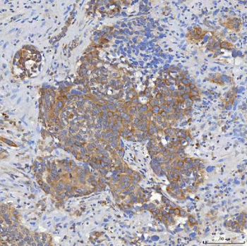 Anti-Mitochondrial dicarboxylate carrier/SLC25A10 Antibody