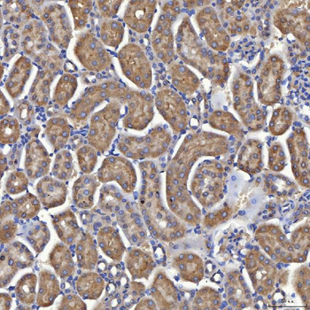 Anti-Mitochondrial dicarboxylate carrier/SLC25A10 Antibody