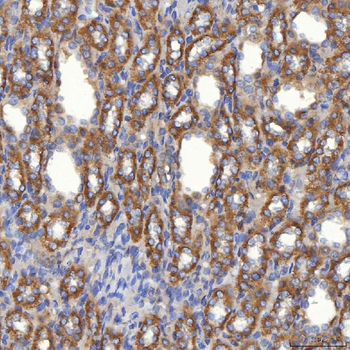 Anti-Mitochondrial dicarboxylate carrier/SLC25A10 Antibody