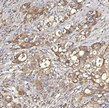Anti-Mitochondrial dicarboxylate carrier/SLC25A10 Antibody