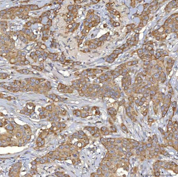 Anti-Mitochondrial dicarboxylate carrier/SLC25A10 Antibody