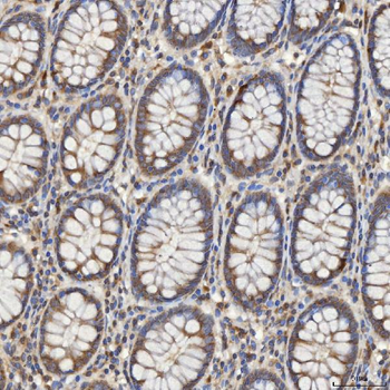 Anti-Mitochondrial dicarboxylate carrier/SLC25A10 Antibody