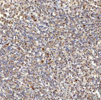 Anti-Mitochondrial dicarboxylate carrier/SLC25A10 Antibody