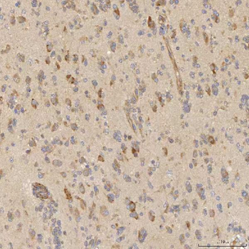 Anti-Mitochondrial dicarboxylate carrier/SLC25A10 Antibody