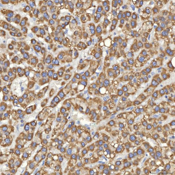 Anti-Mitochondrial dicarboxylate carrier/SLC25A10 Antibody