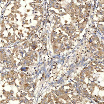 Anti-Mitochondrial dicarboxylate carrier/SLC25A10 Antibody