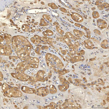 Anti-Mitochondrial dicarboxylate carrier/SLC25A10 Antibody