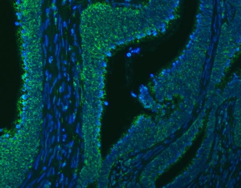 Anti-SLC20A1 Antibody