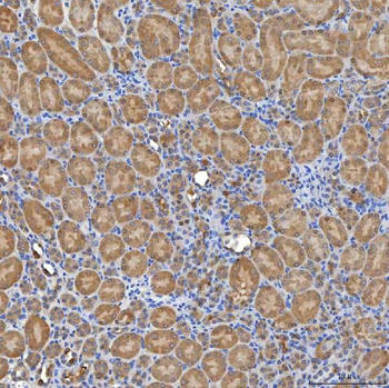 Anti-SLC20A1 Antibody