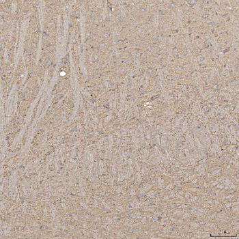 Anti-SLC20A1 Antibody