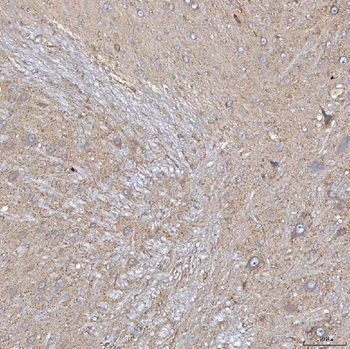 Anti-SLC20A1 Antibody