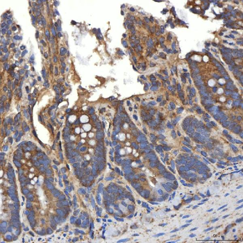 Anti-SLC20A1 Antibody