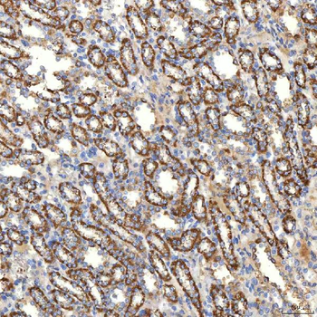Anti-SLC20A1 Antibody